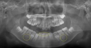 滝歯科医院のブログ たきつべ ー口は命の入り口